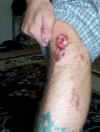 knee_small.jpg (2521 bytes)